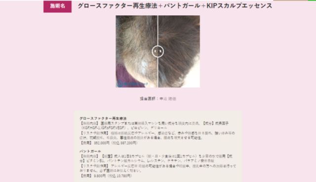 seishinn-hair-regeneration-clinic-case-photo